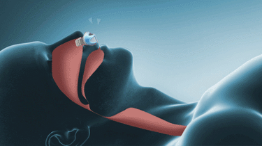 Micro Cpap Machine For Travel & Anti-Snoring Compact Sleep Apnea Alternative - Image 9